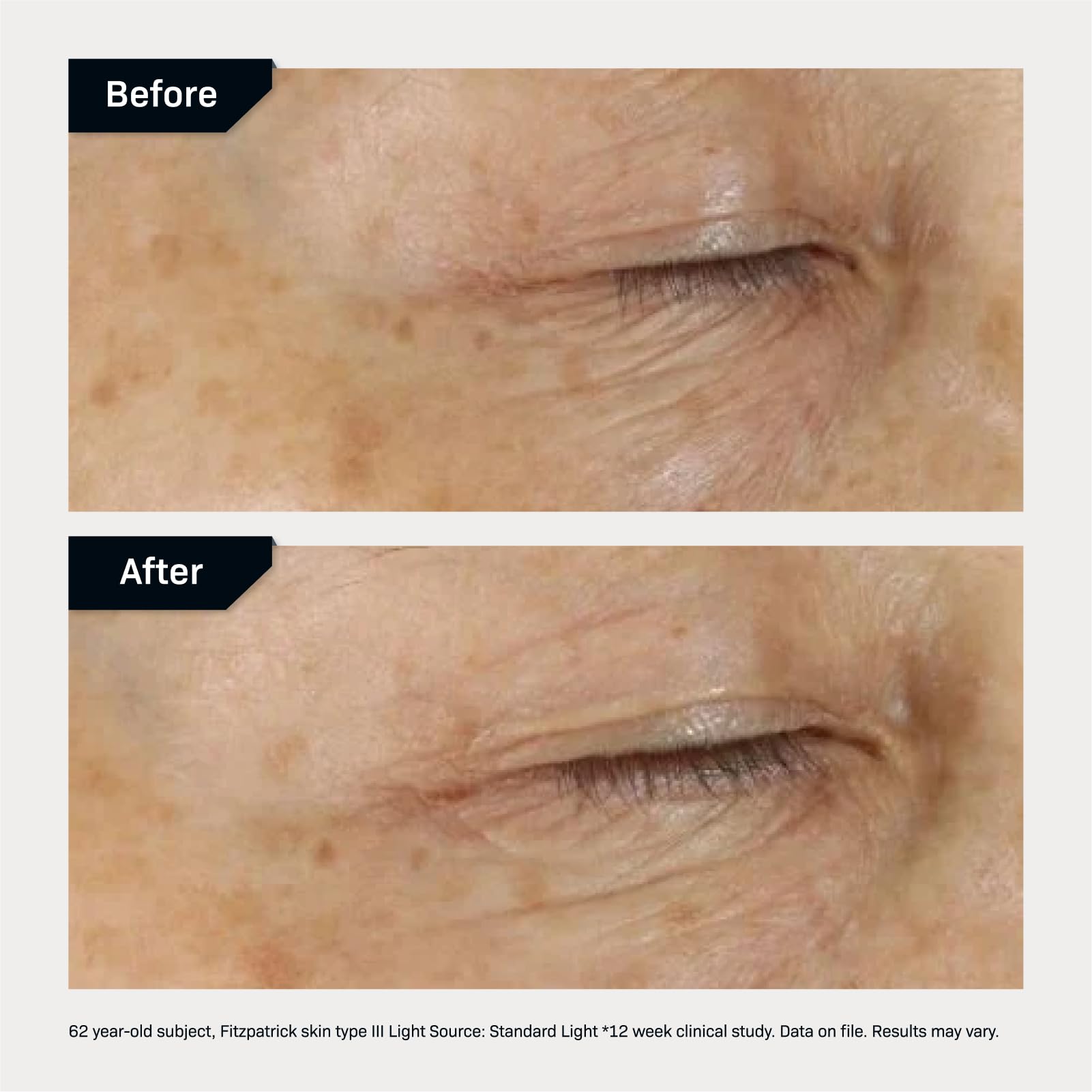 Revision Skincare D·E·J Eye Cream®, Firming and Moisturizing Treatment for Fine Lines, Wrinkles and Crow’s Feet, 0.5 fl oz